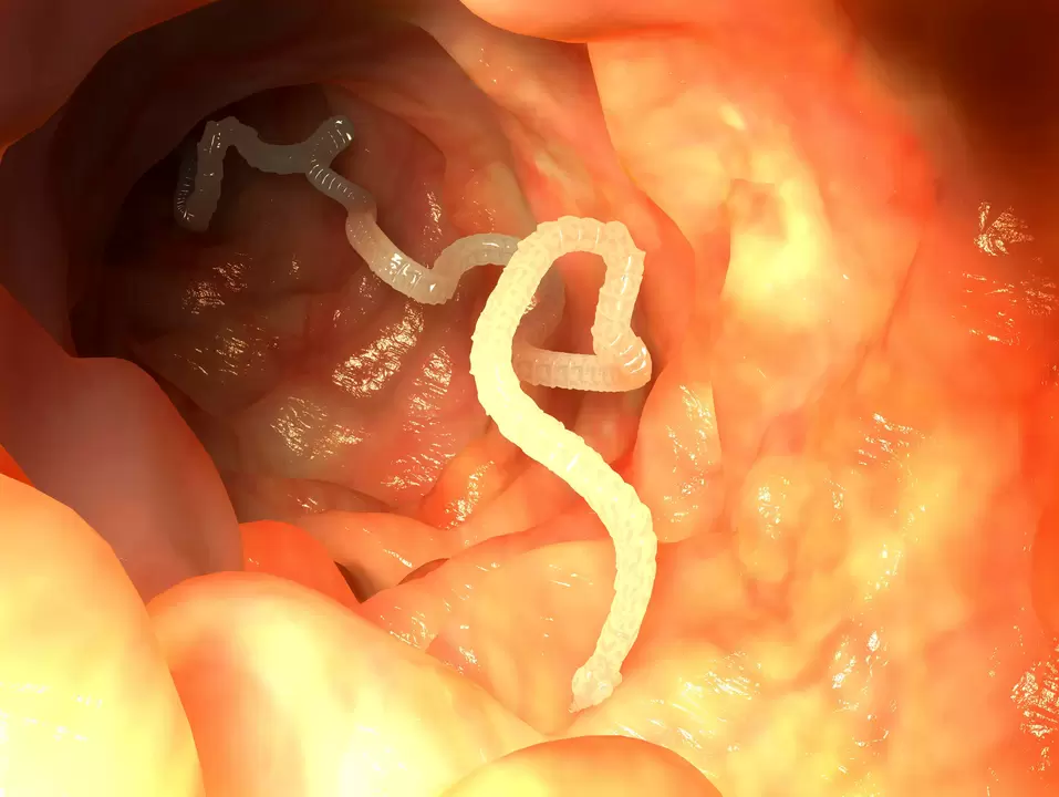human esophageal parasite worm