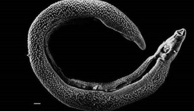 What can parasites live in a person's liver