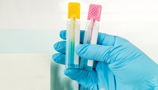 Parasite diagnosis methods