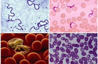 which may be parasites in human blood
